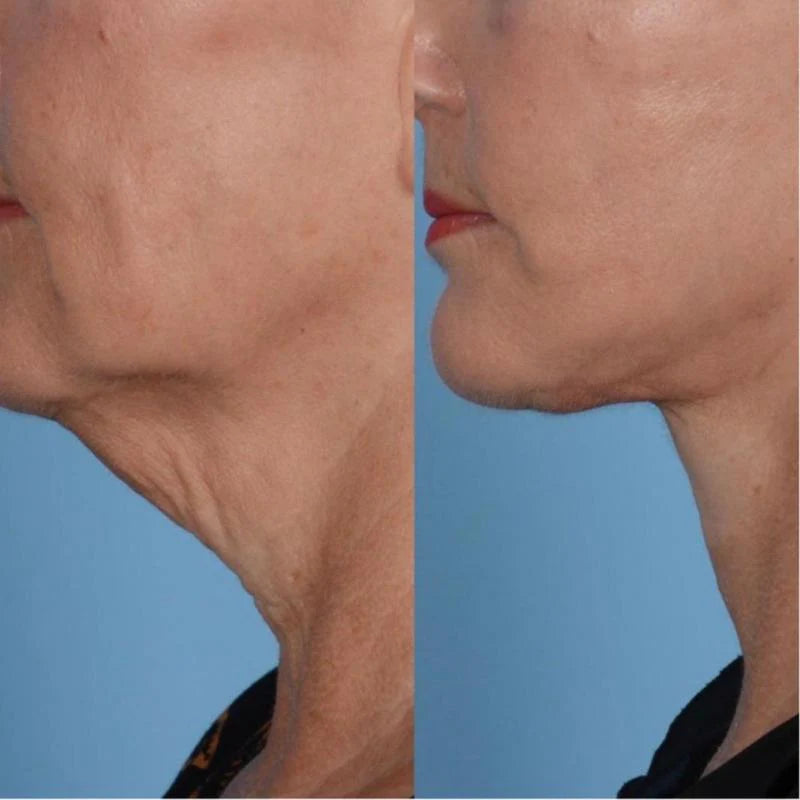 LumiNeck Crema Reafirmante de Cuello