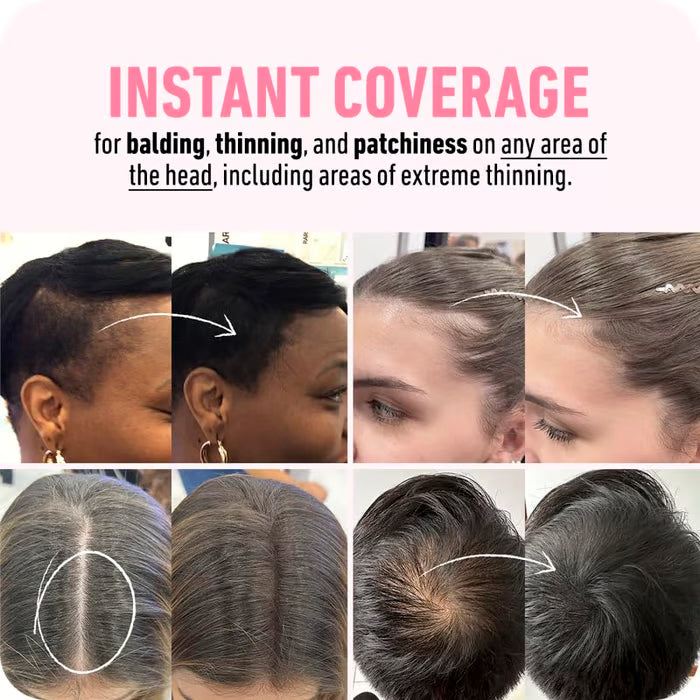 GlowLine: Raíz Perfecta , Adios Canas