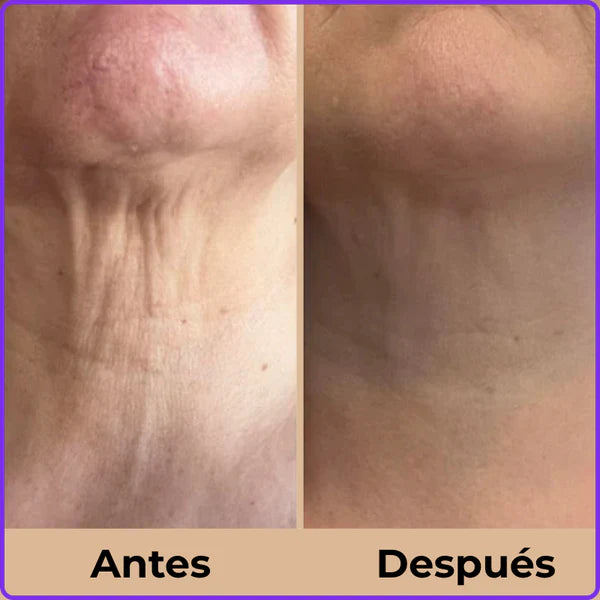 LumiNeck Crema Reafirmante de Cuello