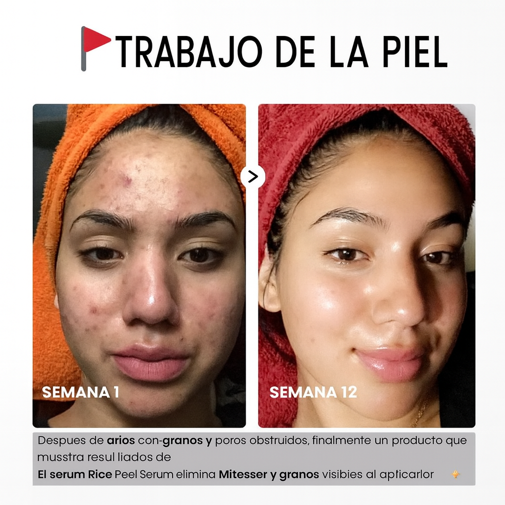 Dr. Melaxin by Lumi™ - tratamiento peeling avanzado