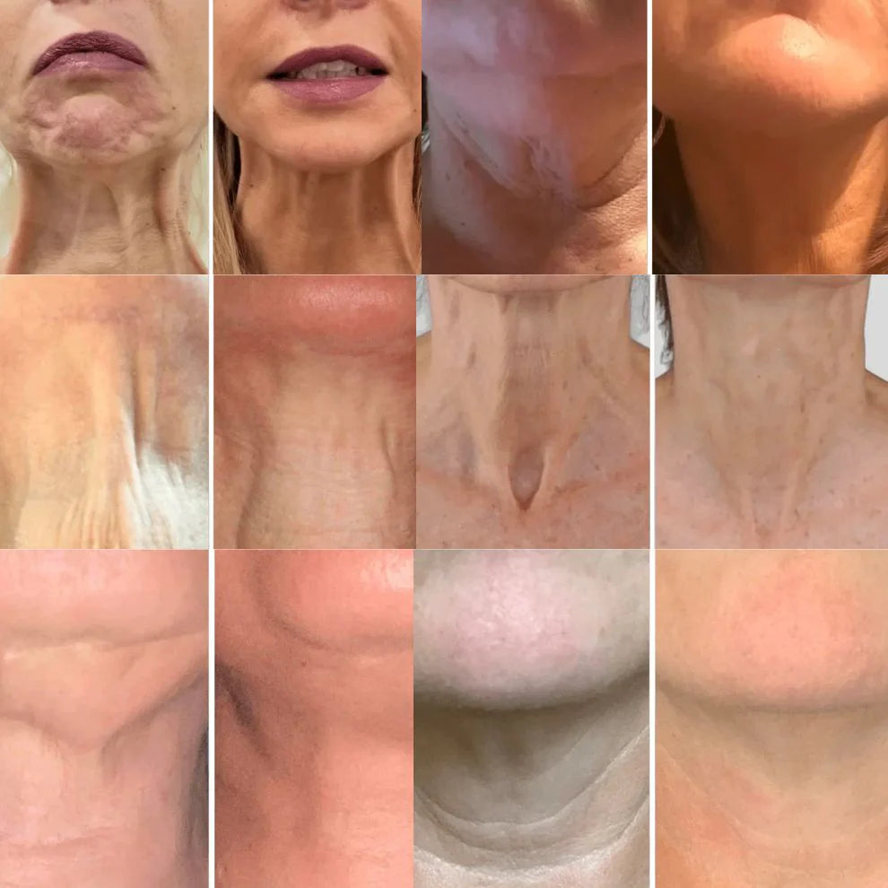 LumiNeck Crema Reafirmante de Cuello