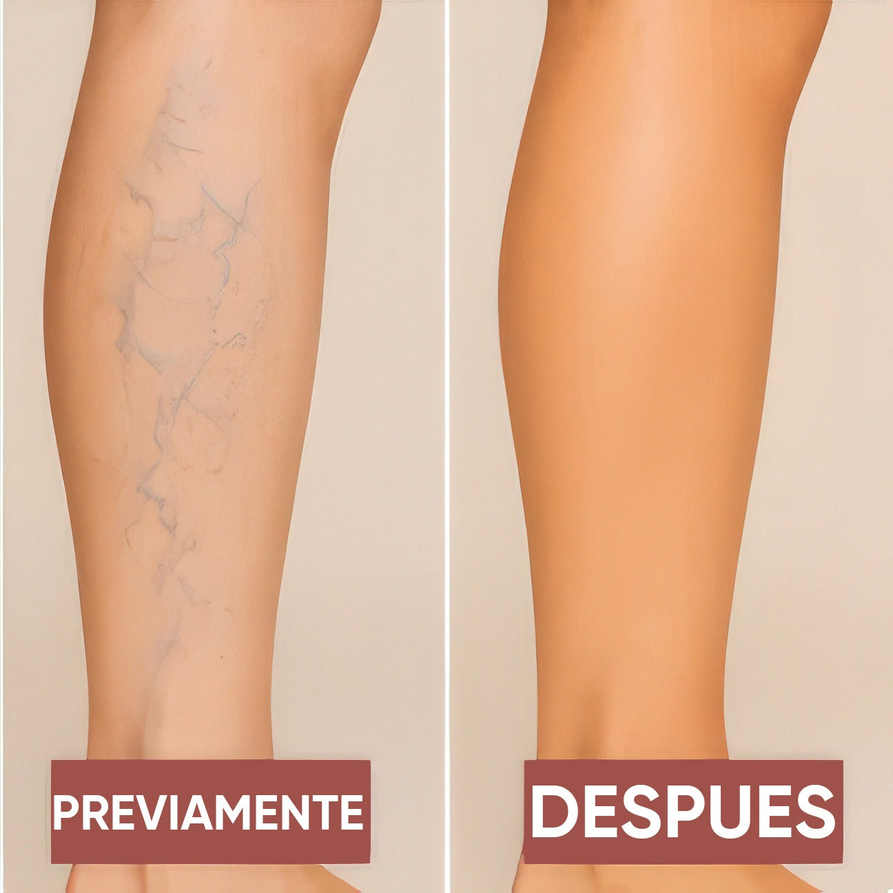 Lumi Legs