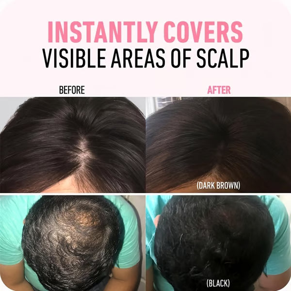 GlowLine: Raíz Perfecta , Adios Canas