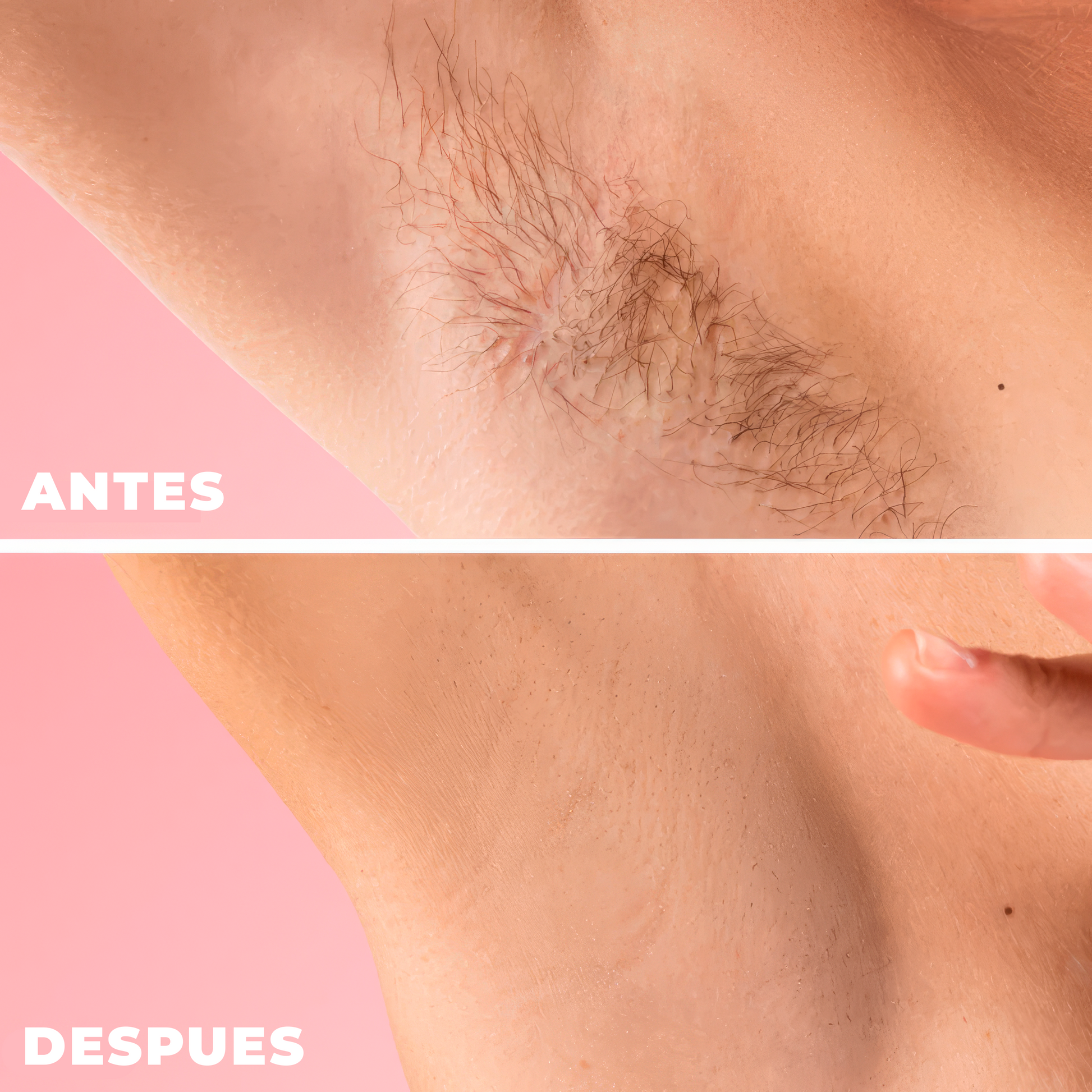 LumiBare™ — Crema Depiladora Total