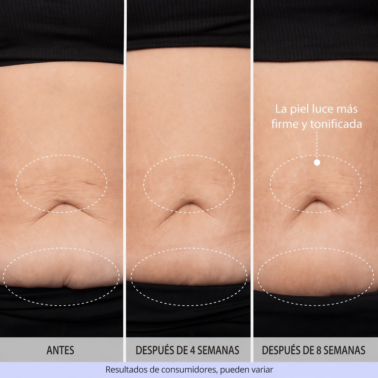 GoPure By Lumi– Crema Antiestrías & Reafirmante Vientre