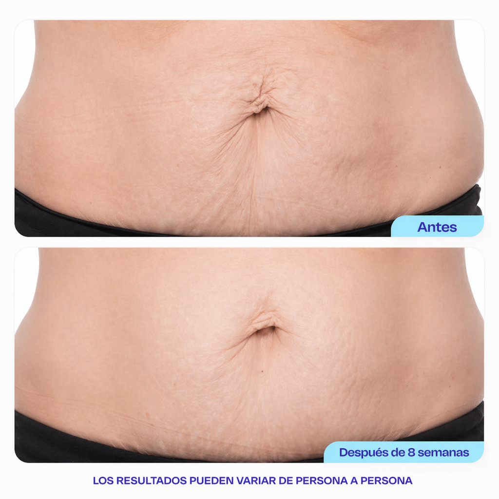 GoPure By Lumi– Crema Antiestrías & Reafirmante Vientre