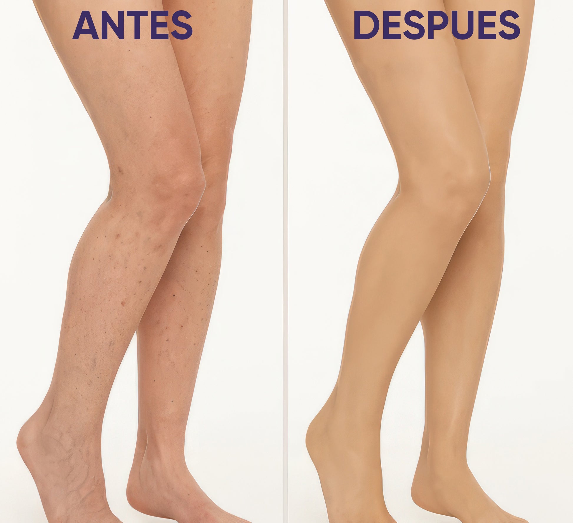 Lumi Legs